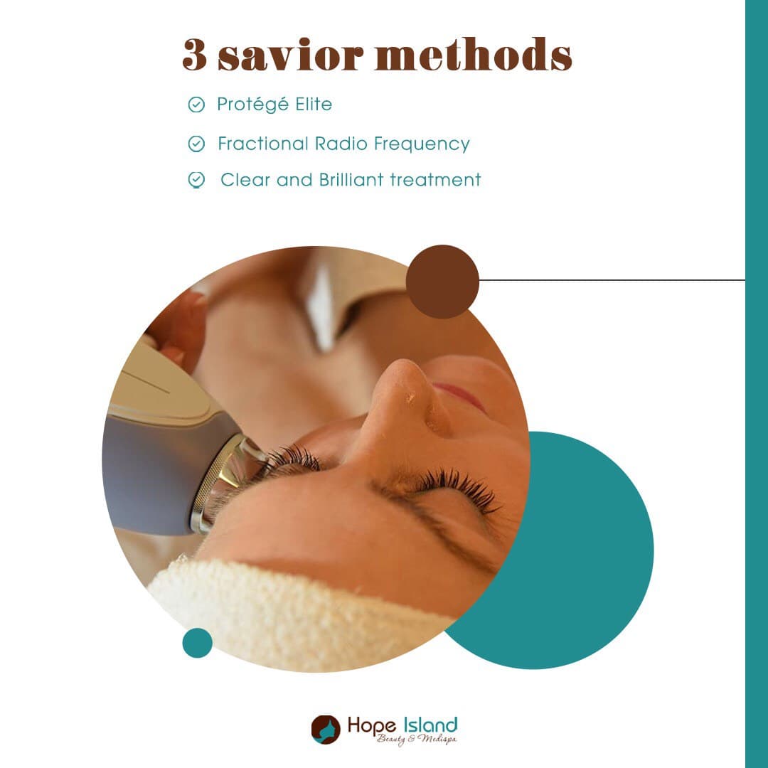 Protégé Elite RF skin tightening treatment at Hope Island Beauty & Medispa