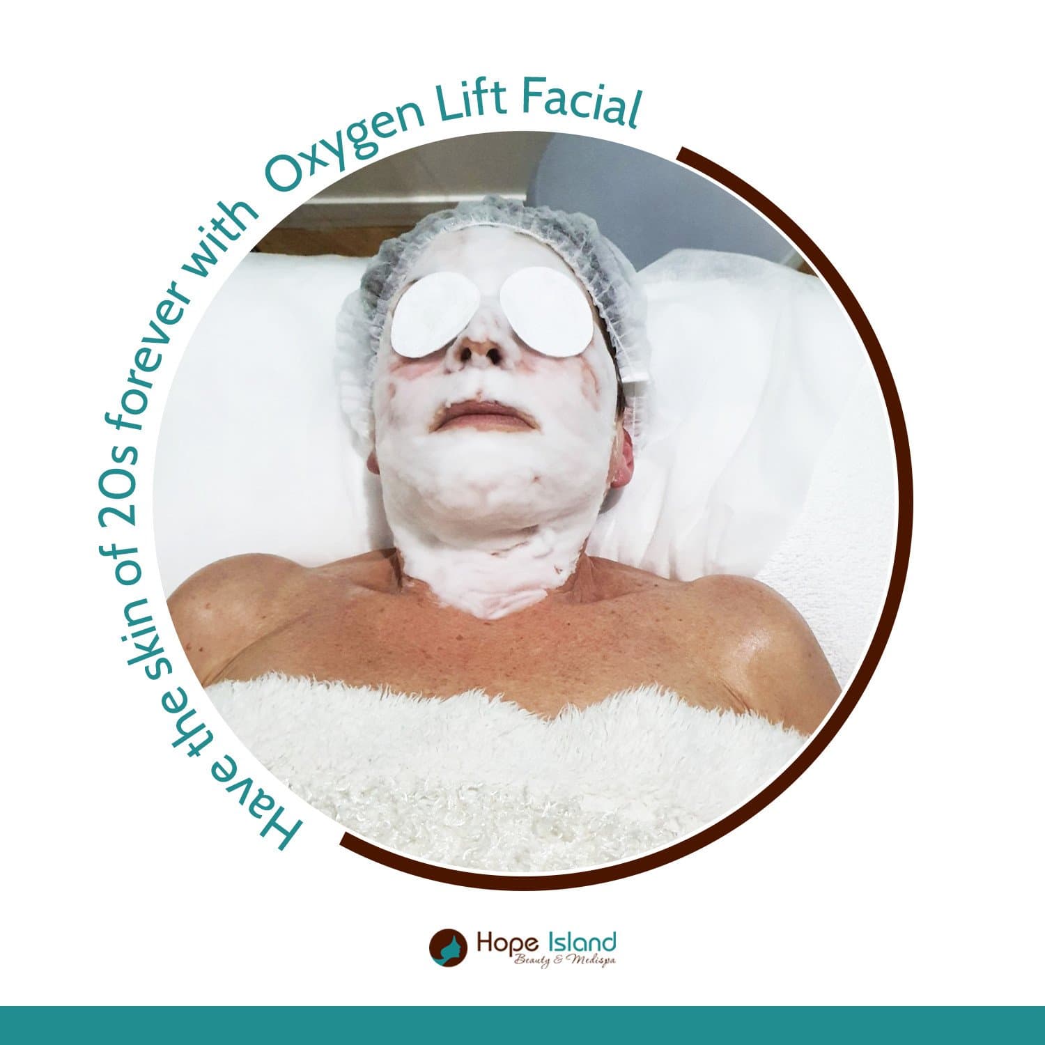 Treatment result at Hope Island Beauty & Medispa