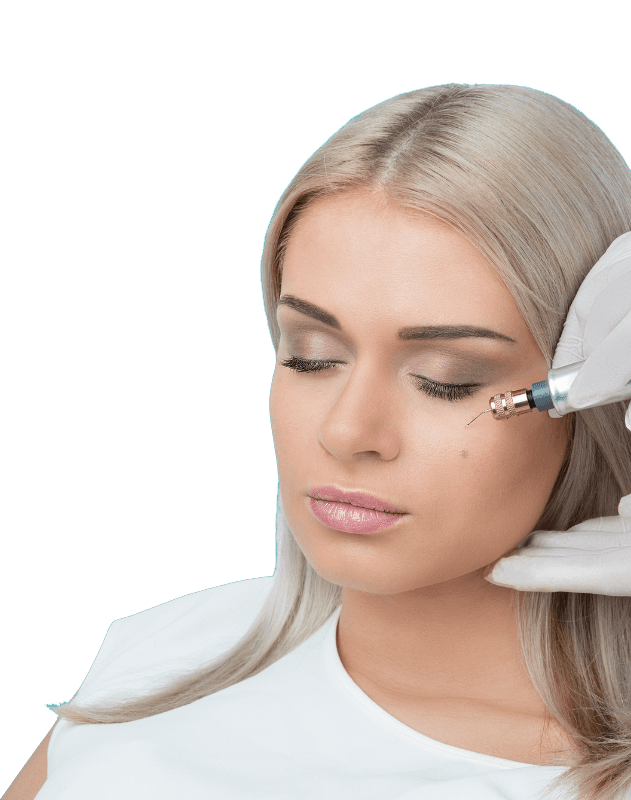Ultra-Plasma Treatments
